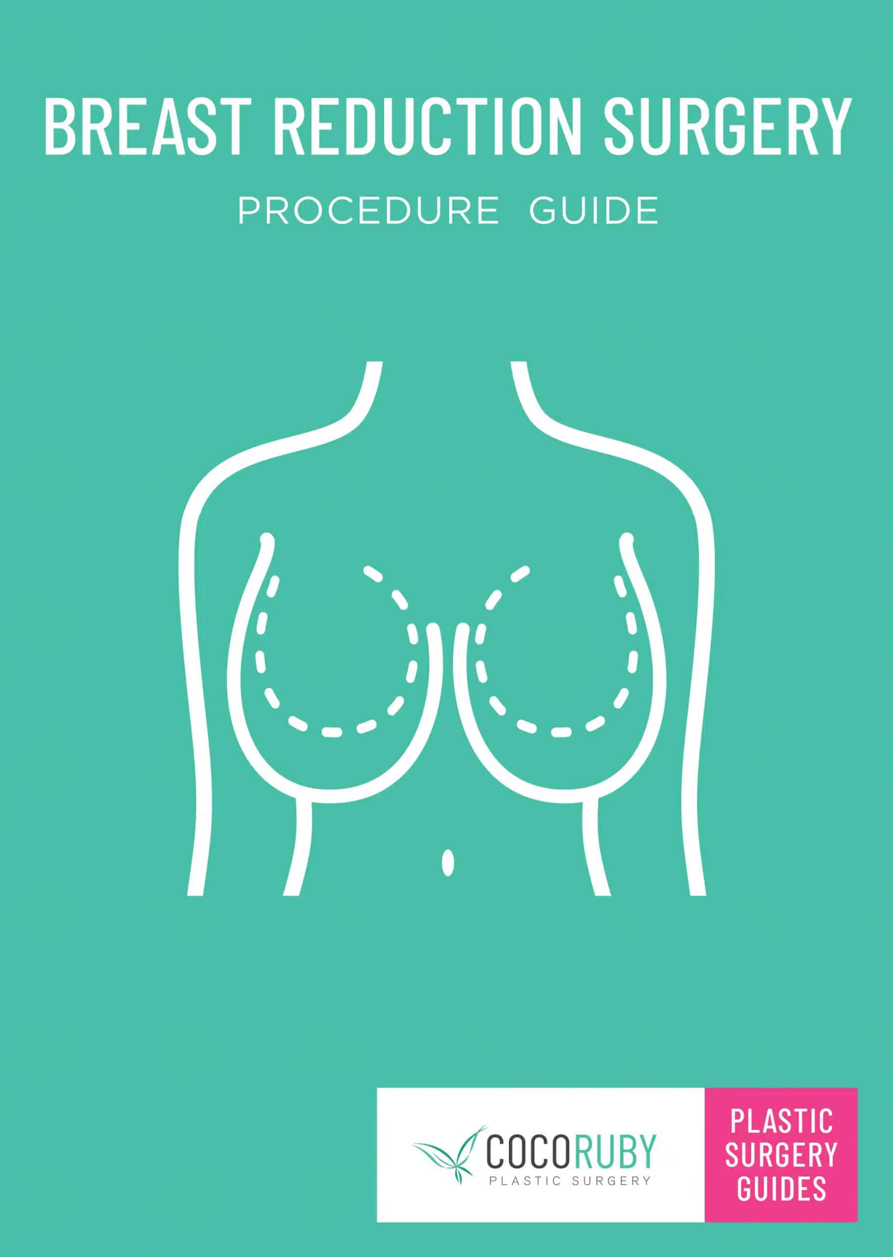 Breast Reduction Download Guide